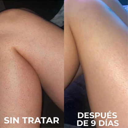Miel Prebiótica® Para mejorar la salud intestinal