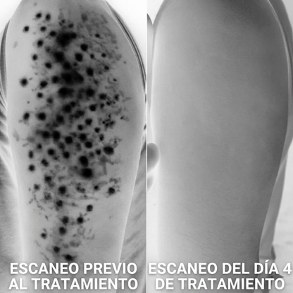 Miel Prebiótica® Para mejorar la salud intestinal